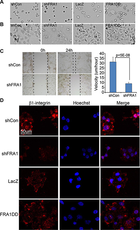 FRA1 promotes cancer cell adhesion and migration.