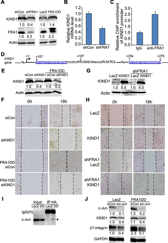 KIND1 is required for FRA1-promotion of cell migration.