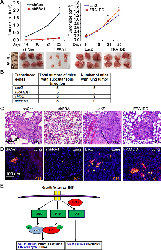 FRA1 is required for tumor growth and metastasis in vivo.