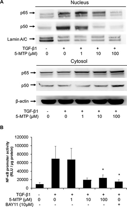5-MTP inhibits TGF-&#x03B2;1-induced NF-&#x03BA;B activation in A549 cells.