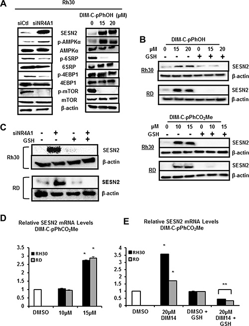 NR4A1 regulates sestrin 2 and mTOR in RMS cells.
