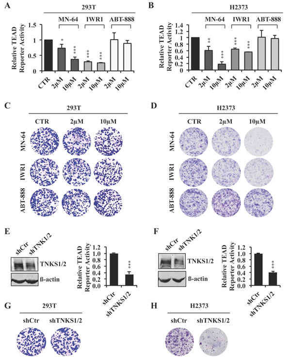 XAV939 downregulates TEAD transcriptional activity through tankyrase inhibition.