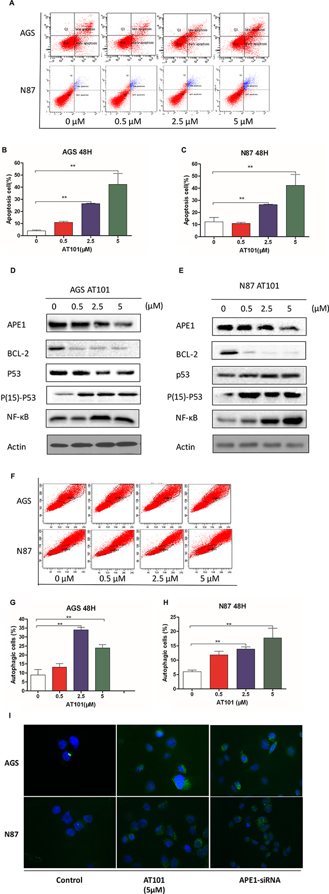 Inhibition of APE1 by AT101 promotes apoptosis and autophagy of gastric cancer cells.