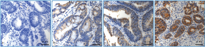 Detection of COX-2 expression using immunohistochemical staining.
