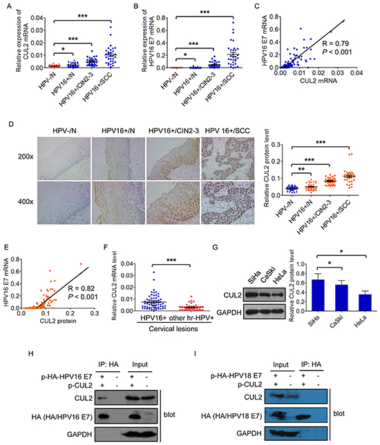 CUL2 is overexpressed and associated with HPV16 E7 in HPV16 induced cervical oncogenesis.