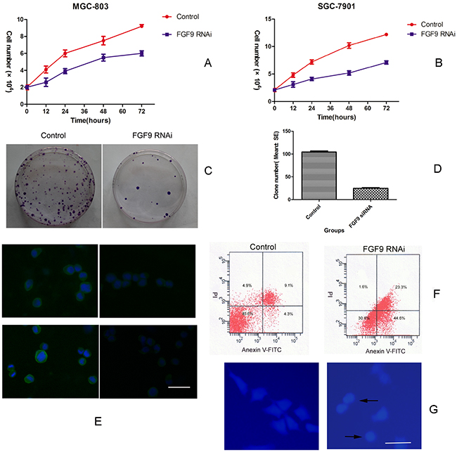Downregulation of FGF9 by siRNA in GC cells inhibits cell growth and induces apoptosis.