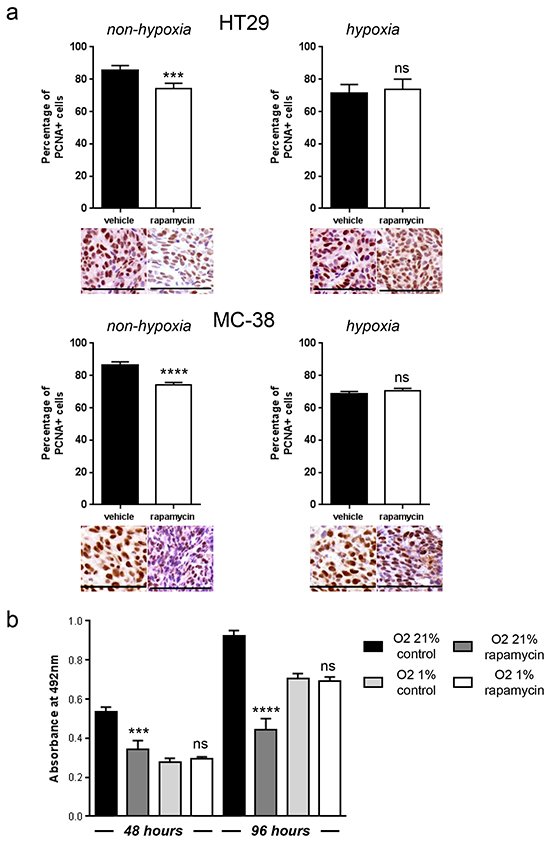 Hypoxic tumor regions proliferate independently of mTORC1 and are resistant to rapamycin.