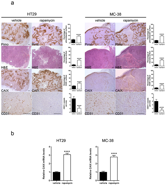 Rapamycin increases carbonic anhydrase IX expression, tumor hypoxia and tumor necrosis and decreases tumor vasculature.