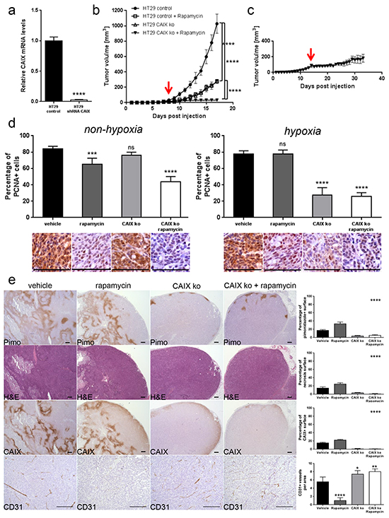 CAIX knockdown exhibits an anti-proliferative effect on hypoxic tumor regions and potentiates anti-cancer efficacy of rapamycin.