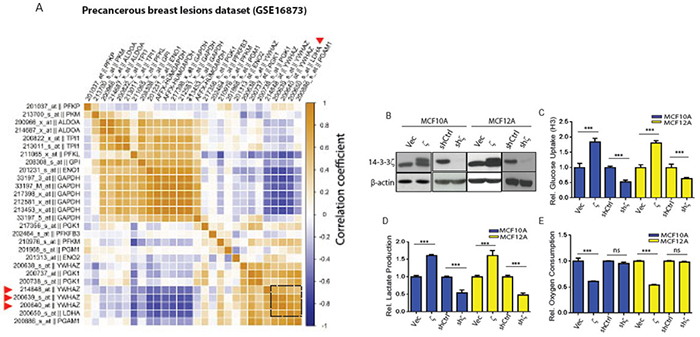 The 14-3-3&#x03B6; expression level correlates with glycolytic genes in early-stage breast cancer patients and its overexpression increases glycolysis in hMECs.