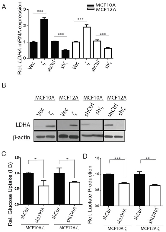 14-3-3&#x03B6; overexpression increases glycolysis by upregulating LDHA mRNA and protein expressions in hMECs.