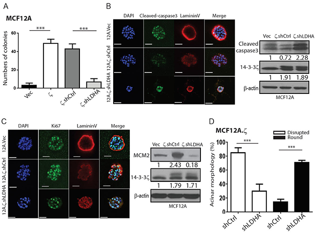 14-3-3&#x03B6;-mediated LDHA upregulation contributes to the early-stage transformation of hMECs.