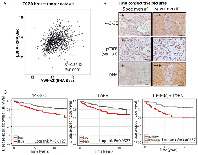 The 14-3-3&#x03B6;-LDHA signaling axis holds prognostic value in predicting clinical outcome.