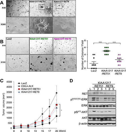 Validation of enhanced tumorigenic activities in cells expressing KIAA1217-RET fusion protein.