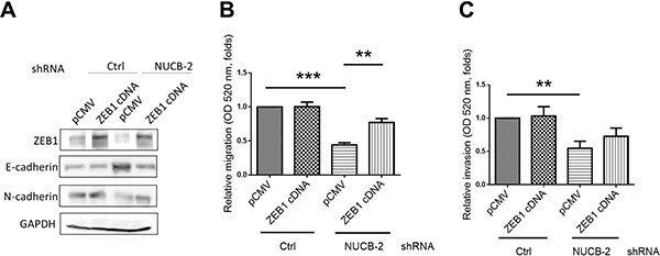Suppression of NUCB-2 inhibited through regulation of ZEB-1.