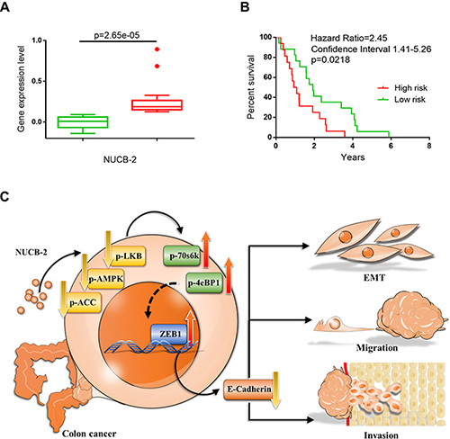 NUCB-2 enhanced metastasis in colon cancer.