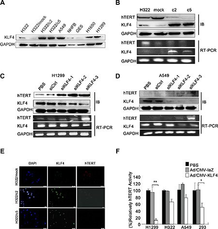 KLF4 negatively regulated hTERT expression in lung cancer cell lines.