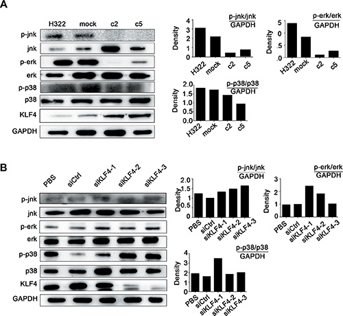 KLF4 suppressed lung cancer cell growth and hTERT expression via the MAPK signaling pathway.