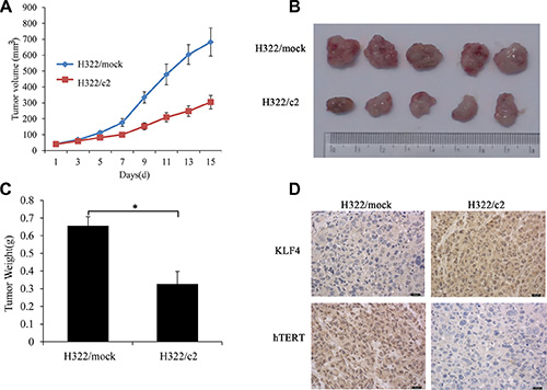 KLF4 suppresses lung tumor formation and hTERT expression in vivo.