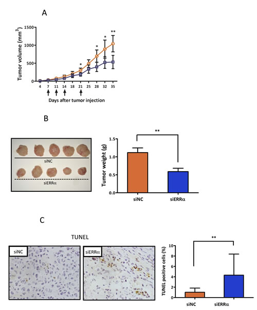 Effect of ERR&#x3b1; knockdown on proliferation and angiogenesis of endometrial cancer cells