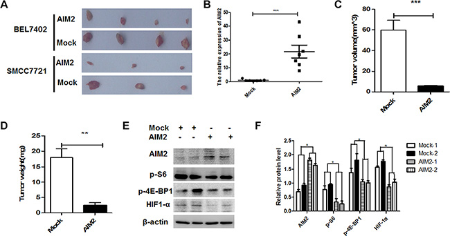Exogenous overexpression of AIM2 suppressed xenotransplant tumor growth in nude mice.