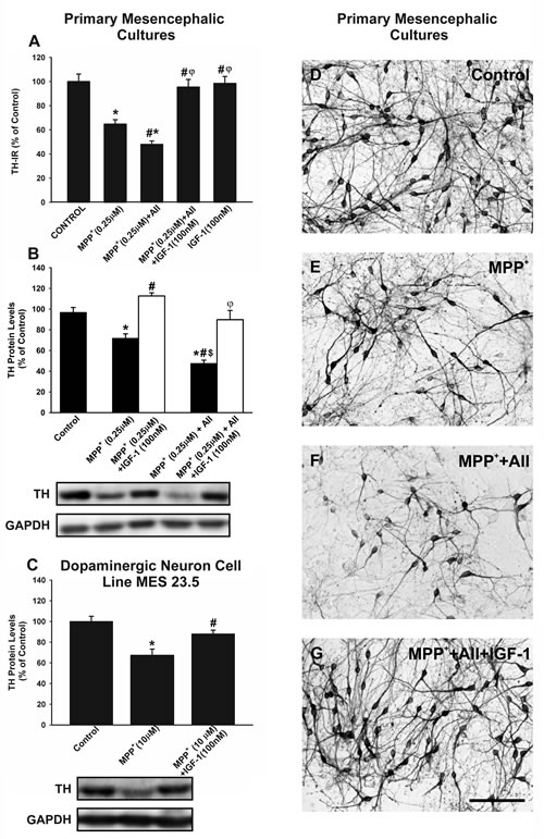 Effects of treatment with AII and IGF-1 on MPP+-induced neurotoxicity in dopaminergic (TH-ir) neurons.
