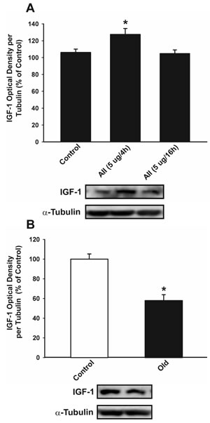 Effect of intraventricular injection of AII in IGF-1 expression in the nigral region of rats.
