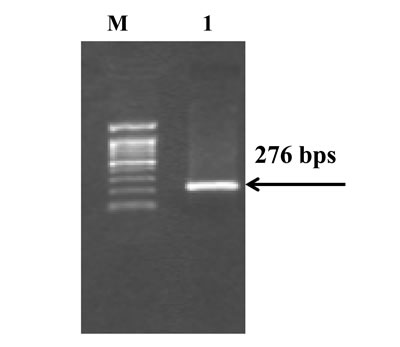 Amplified gene fragment of interest by PCR M= 100bp DNA Marker; Lane 1 = PCR products containing polymorphic site of rs 1800925.