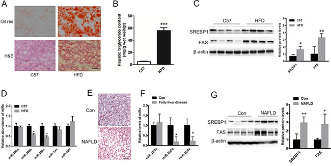 The levels of miR-200b and miR-200c are reduced in the steatotic livers of NAFLD patients and mice fed a HFD.