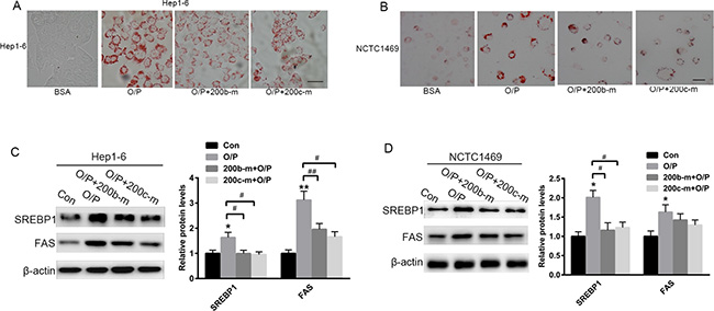 The over-expression of miR-200b and miR-200c reverses oleic acid/palmitic acid-induced lipid accumulation in hepatocytes.