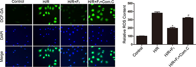 Influence of AMPK inhibitor compound C on F2-mediated decreases in ROS levels in CMECs after H/R, as assessed by DCFH-DA staining.