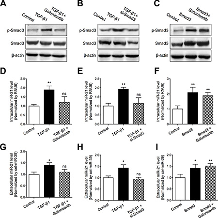 TGF-&#x03B2;/Smad3 signaling pathway mediated miR-21 secretion.