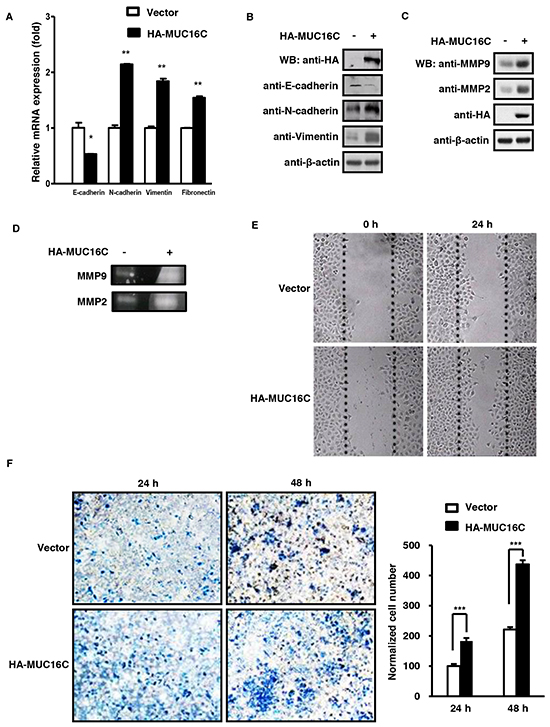 MUC16C promotes cell migration and invasion.