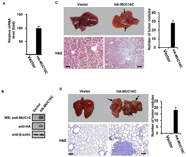 Over-expressed MUC16C enhances metastasis capability of SKOV-3 cells in vivo.