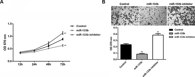 miR-133b overexpression could decrease the cell proliferation and invasion of glioma cells.