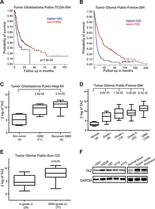 High TAZ expression is a prognostic indicator of poor survival in glioblastoma patients.