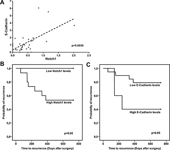Notch1 and E-Cadherin correlate in human HCC and predict TTR.