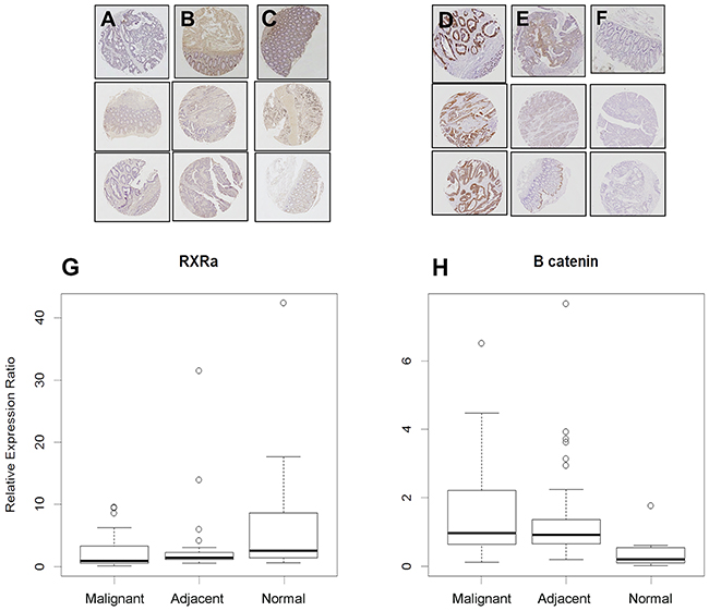 RXR&#x03B1; and &#x03B2;-catenin immunostaining in human tissues.