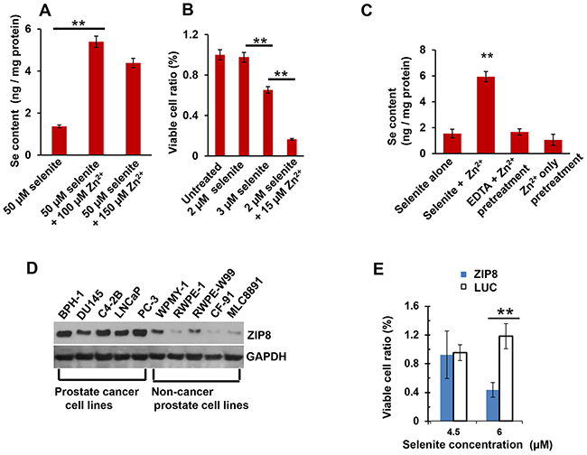 Intracellular Se content and toxicity; ZIP8 protein levels in human prostate cancer cells.