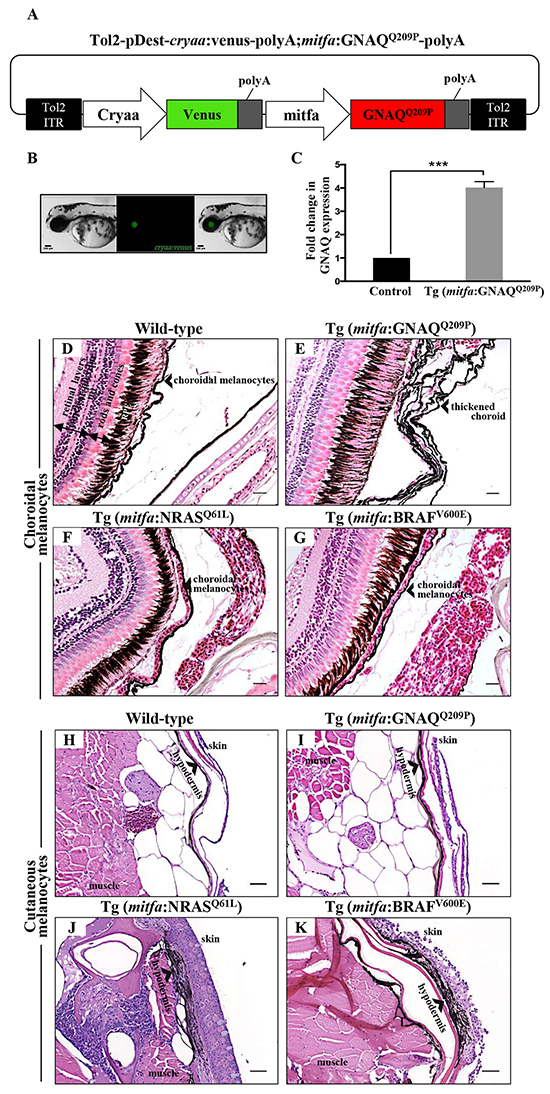 Only oncogenic GNAQQ209P is sufficient to induce choroidal melanocyte hyperplasia.