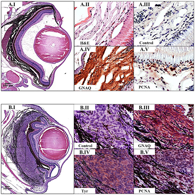 Validation of GNAQQ209P-driven choroidal hyperplasia and uveal tumours in Tg (mitfa:GNAQQ209P;p53M214K/M214K) zebrafish.