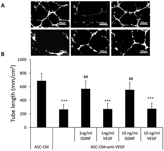 Addition of GDNF into ASC-CM pretreated with the excess amount of the VEGF antibody was able to stimulate HUVECs tube formation.