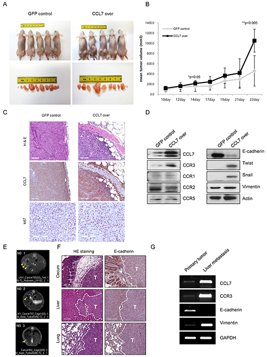 CCL7 overexpression provokes tumorigenicity and metastasis in HCT116 cells in vivo.