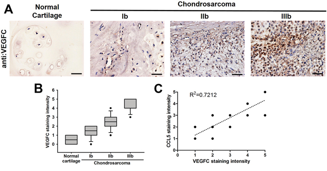 Clinical significance of CCL5 and VEGF-C expression in specimens of chondrosarcoma patients.