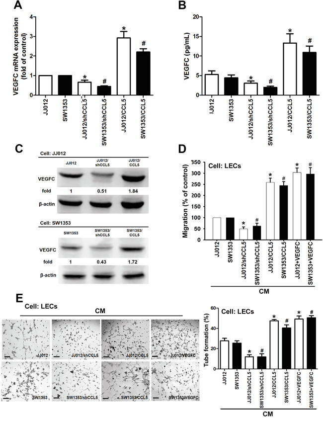 CCL5 promotes lymphangiogenesis by VEGF-C production in human chondrosarcoma cells.