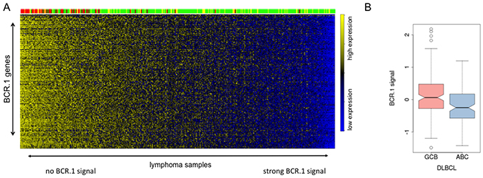 The BCR.1 index characterizes individual aggressive NHL and discriminates between ABC- and GCB-like DLBCL.