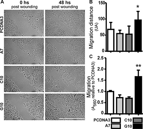 Catalase overexpression induced melanoma cell migration.