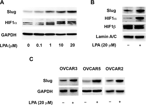 LPA-signaling activates the transcription factors Slug and HIF1&#x03B1;.