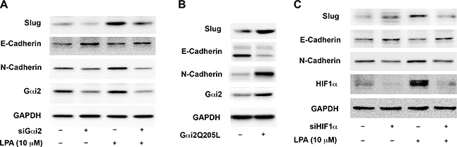 LPA stimulates the expression of EMT markers in ovarian cancer cells via G&#x03B1;i2 and HIF1&#x03B1;.