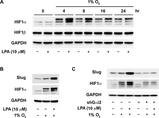 G&#x03B1;i2 stimulates an increase in the levels of HIF1&#x03B1; in hypoxia.